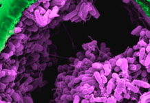 Primed for battle: helping plants fight off pathogens by enhancing their immune systems