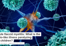 Acute flaccid myelitis: What is the polio-like illness paralyzing US children?