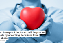 Heart transplant doctors could help more people by accepting donations from the obese