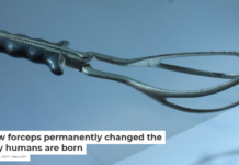 How forceps permanently changed the way humans are born