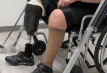 Diabetic foot wounds kill millions, but high-tech solutions and teamwork are making a difference