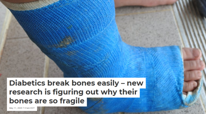 Diabetics break bones easily – new research is figuring out why their bones are so fragile