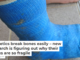 Diabetics break bones easily – new research is figuring out why their bones are so fragile