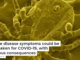 Lyme disease symptoms could be mistaken for COVID-19, with serious consequences