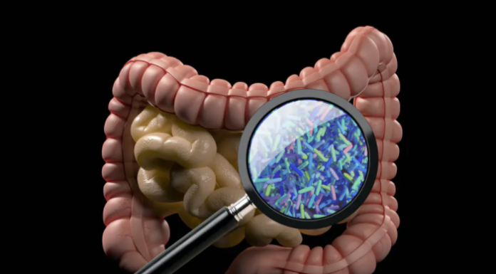 Fecal microbe transplants help cancer patients respond to immunotherapy and shrink tumors