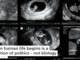 When human life begins is a question of politics – not biology