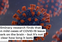 Preliminary research finds that even mild cases of COVID-19 leave a mark on the brain – but it’s not yet clear how long it lasts