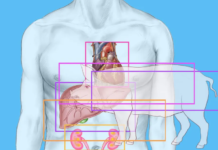 Organs from genetically engineered pigs may help shorten the transplant wait list