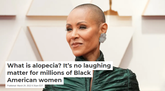 What is alopecia? It’s no laughing matter for millions of Black American women