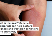 What is that rash? Genetic fingerprints can help doctors diagnose and treat skin conditions more effectively