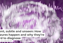 Silent, subtle and unseen: How seizures happen and why they’re hard to diagnose