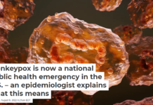 Monkeypox is now a national public health emergency in the U.S. – an epidemiologist explains what this means