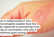 What is inflammation? Two immunologists explain how the body responds to everything from stings to vaccination and why it sometimes goes wrong