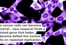 How cancer cells can become immortal – new research finds a mutated gene that helps melanoma defeat the normal limits on repeated replication