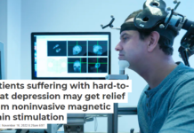 Patients suffering with hard-to-treat depression may get relief from noninvasive magnetic brain stimulation