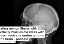 Treating mental illness with electricity marries old ideas with modern tech and understanding of the brain – podcast