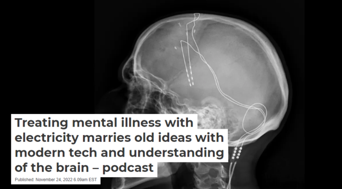 Treating mental illness with electricity marries old ideas with modern tech and understanding of the brain – podcast