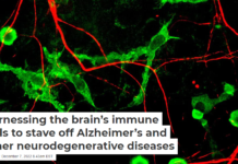 Harnessing the brain’s immune cells to stave off Alzheimer’s and other neurodegenerative diseases