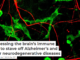 Harnessing the brain’s immune cells to stave off Alzheimer’s and other neurodegenerative diseases