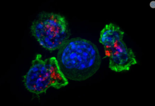 Anti-cancer CAR-T therapy reengineers T cells to kill tumors – and researchers are expanding the limited types of cancer it can target
