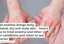 Cold weather brings itchy, irritated, dry and scaly skin – here’s how to treat eczema and other skin conditions and when to see a doctor