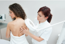 Skin cancer screening guidelines can seem confusing – three skin cancer researchers explain when to consider getting checked