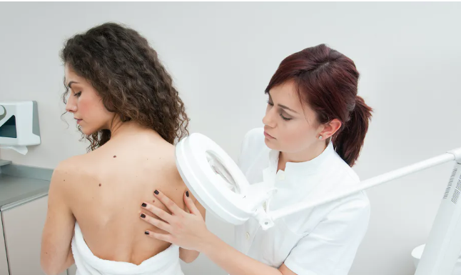 Skin cancer screening guidelines can seem confusing – three skin cancer researchers explain when to consider getting checked