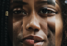 Racism produces subtle brain changes that lead to increased disease risk in Black populations