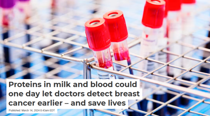 Proteins in milk and blood could one day let doctors detect breast cancer earlier – and save lives