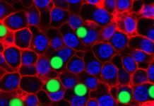 We transformed living cells into tiny lasers