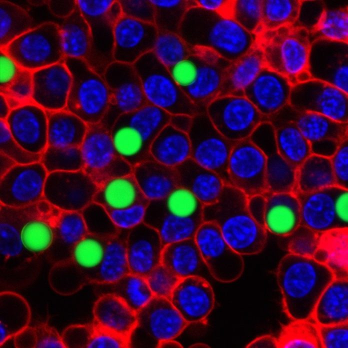 Green lasers glowing within cells. Matjaž Humar and Seok Hyun Yun, CC BY-ND