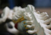 Chiropractic therapy: placebo or panacea?