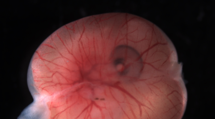 Using the placenta to understand how complex organs evolve