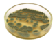 Why you may not need all those days of antibiotics