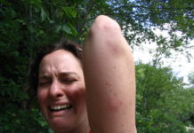 Health Check: why mosquitoes seem to bite some people more